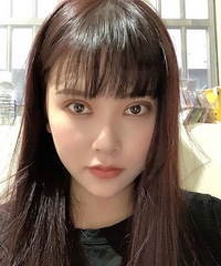 双眼皮三个月,后悔不该盲目选择太宽的双眼皮