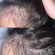 都没看出我值了发际线