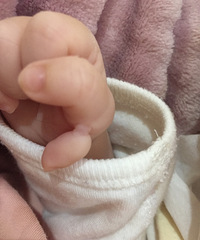 记录儿童医院烧伤整形科门诊手术