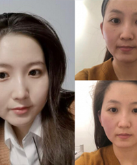 没想到做了这个事,法令纹成功变浅了