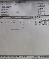 少熬夜!接诊5个大学生,其中3个卵巢早衰
