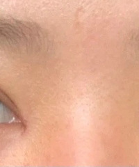 做了双眼皮,同事都说和流金岁月倪妮眼睛是同款