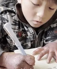 上长满冻疮,裂口流着血,无法想象这是小学生的手……