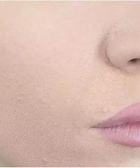 �۵�Һ���ۣ������Ƿ۵�Һ���⻹��Ƥ�����⻹���ַ�����