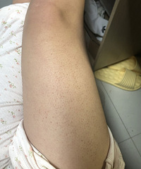 �򵥼�¼һ�£�ȥ��Ƥ�ĵ�һ��