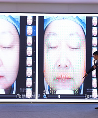 抗衰神器fotona4d效果到底如何?直播给你们看