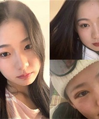 做双眼皮后,同事说我眼睛和倪妮是同款