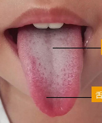 通过观察舌苔可以知道孩子的身体状态