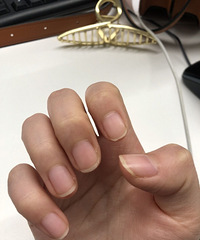 太有用了这个办法,再也不怕倒刺烦恼了