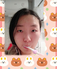 来吧显示,秀一下没做多久的双眼皮