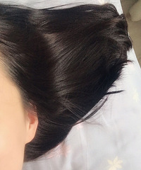 拯救秃头别找老中医!找了就是养生+养发