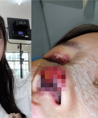 ��Ա��������ʧ�ܱǼ⻵�����ÿ���