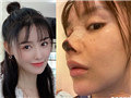 演员高溜整容失败