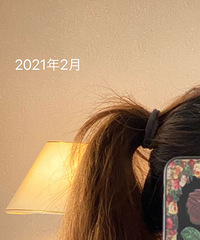 没想有一天我也会为了脱发而烦恼