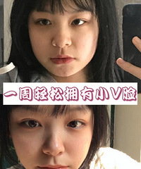 大脸姐妹看过来!睡前3分钟,一周拥有小V脸
