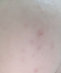 来自皮肤科医生的7条忠告!赶紧进来学点变美干货