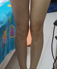 周六野瘦腿,打卡10天的效果