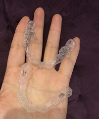 牙套已过半,怀着激动的小心情记录一下。