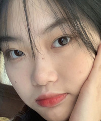 点痣不留印子的办法,我也get到了