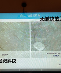 分享皮肤常年不长痘不敏感的秘诀,维稳全靠它