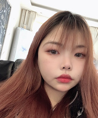 分享我的变美心得~面部吸脂