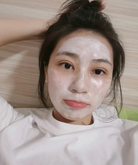 贴了那么多年双眼皮,终于做了手术,安逸