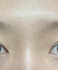 卸妆前发现脸上的白头都浮起来了(有图慎入)