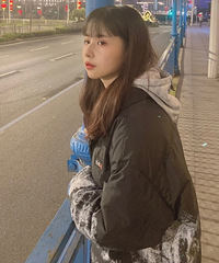 朋友都说我的双眼皮做得太深了,你们帮我看看呢