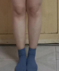 真的不要翘二郎腿了,姐妹们(有对比图)