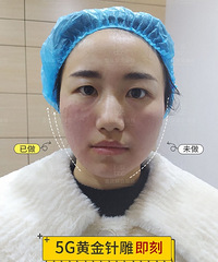 25岁开始我的抗衰之路,拯救法令纹就靠它了