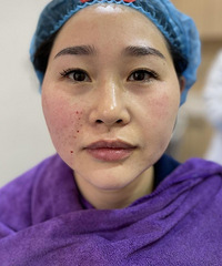女人30岁就成黄脸婆?其实抗衰也没那么难啊