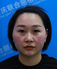 女人30岁就成黄脸婆?其实抗衰也没那么难啊!