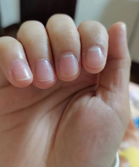 有没有手干到脱皮的姐妹,大家一起交流怎么护手啊!