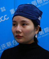 30岁老阿姨终于甩掉双下巴,臃堆脸,瞬间年轻5岁