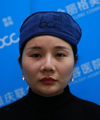 30岁老阿姨终于甩掉双下巴,臃堆脸,瞬间年轻5岁