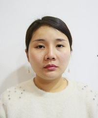 30岁老阿姨终于甩掉双下巴,瞬间年轻5岁