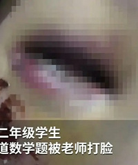 老师打学生伤情触目惊心,官方通报:老师误打学生
