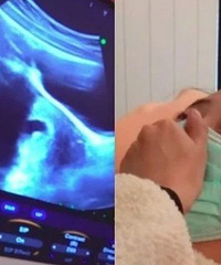 ��С�����ڻ���ȴ̥ͣ������̫����