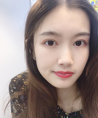 都说我有了双眼皮气质变了,“男人婆”变小仙女