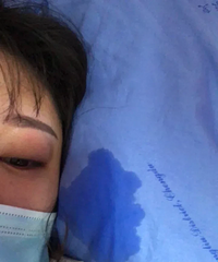 36小时生产经历,顺和剖腹产两种痛都经历了