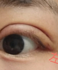 ˫��Ƥ�޸��������ڲ��ٵ�����ʧ�ܵ�˫��Ƥ��