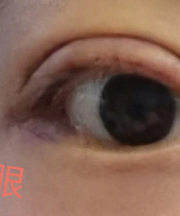 ˫��Ƥ�޸��������ڲ��ٵ�����ʧ�ܵ�˫��Ƥ��