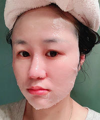 记录帖:打了4次水光针后的变化,黑头痘痘好了,化妆都变服帖