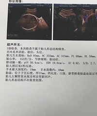 如果发现自己好不容易有的宝宝有畸形,还会生下他们吗?