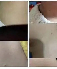 北京一幼儿园托班多名孩子身上现红点,疑似针眼