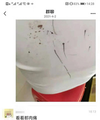 广州一小学生被同学用铅笔戳伤,伤口超过20处