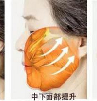 北京崔鹏医生:迷你小拉皮的原理及优点?