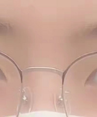 辣妈产后变美行动:全切双眼皮让眼睛放大一倍