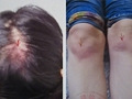 起诉离婚5年被驳回