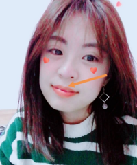 女大十八变,我的整牙日记